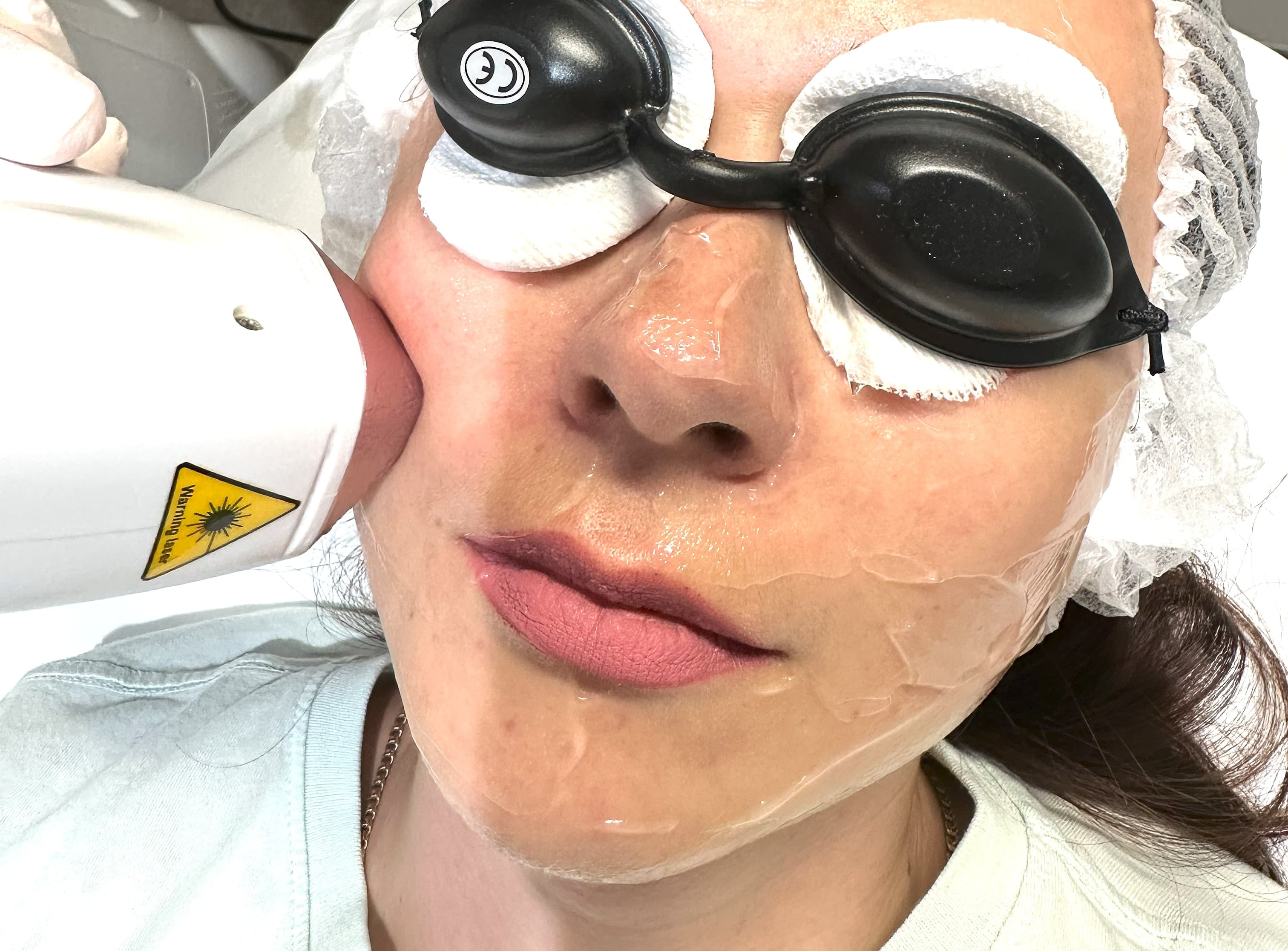 Diode Skin Rejuvenation